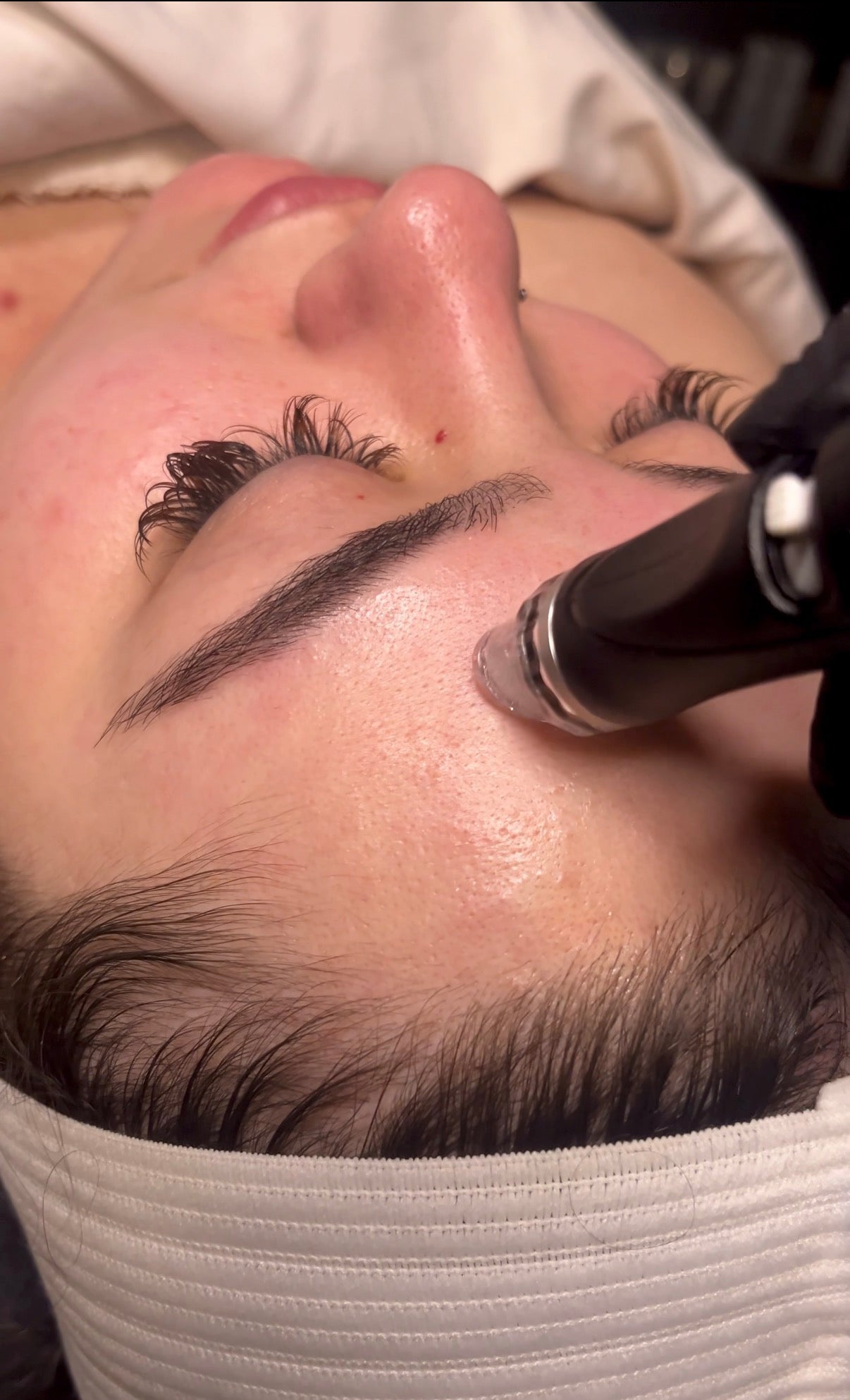 Hydrafacial 3 package